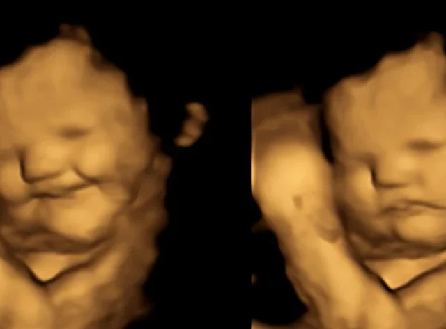 Babies kunnen huilen en lachen ik de baarmoeder