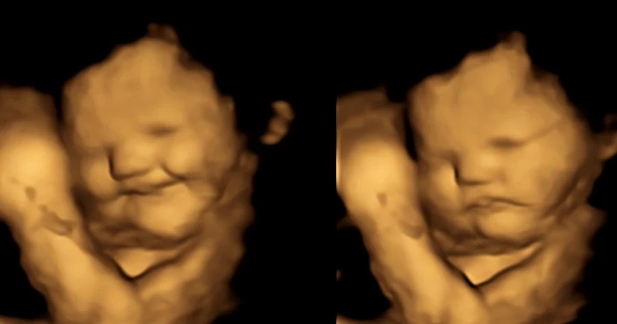 emoties van baby in baarmoeder tijdens zwangerschap