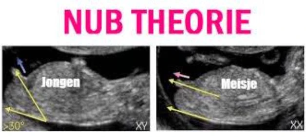 nub theorie geslachtsbepaling jongen of meisje